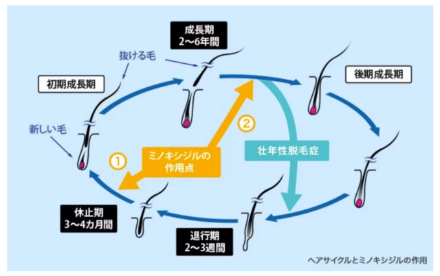 ミノキシジルとヘアサイクル