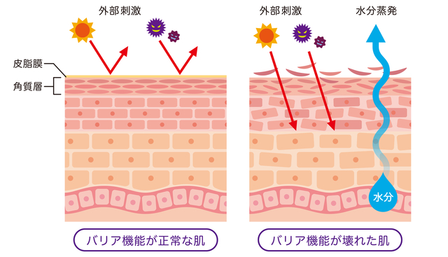 皮膚バリア